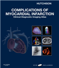 Complications of Myocardial Infarction-2009